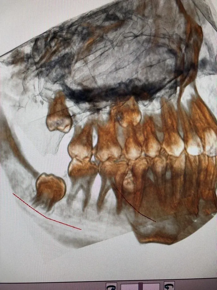 Bucci - Chirurgia Orale