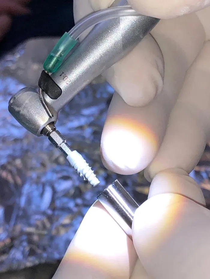 Bucci - Impianti dentali